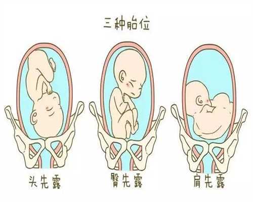 靠谱代孕医院哪家好,最好的代孕机构代孕期性生活的正确姿势主要有哪些？_代