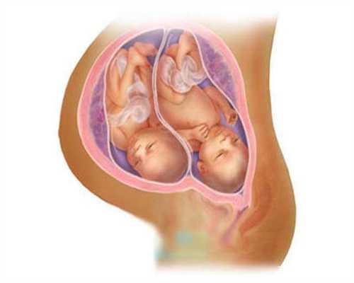 包成功代孕网-代孕网排名-代孕能生双胞胎吗