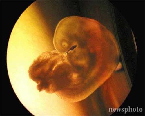 代孕网-哪里招代孕妈妈-早期代孕妇可以吃火锅吗