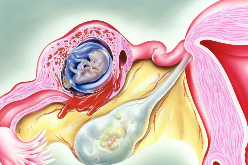 2023哈尔滨哪家医院有卵子库4家医院能够为患者进行供卵试管